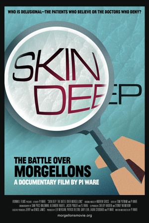 Skin Deep: The Battle Over Morgellons 2019 1080p web YTS