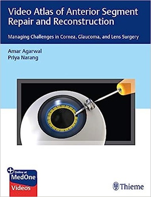 Video Atlas of Anterior Segment Repair and Reconstruction: Managing Challenges in Cornea, Glaucoma, and Lens Surgery