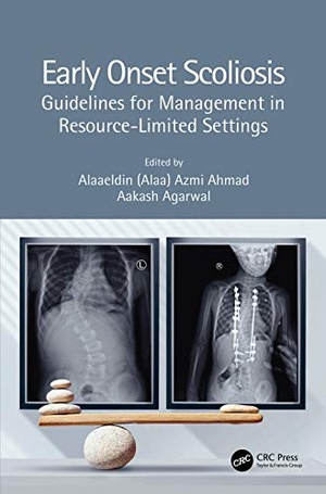 [ DevCourseWeb ] Early Onset Scoliosis - Guidelines for Management in Resource-Limited Settings