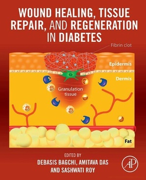 [ FreeCourseWeb ] Wound Healing, Tissue Repair, and Regeneration in Diabetes