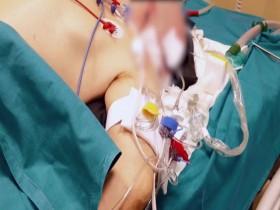 Coronavirus Explained S01E01 480p x264-mSD [eztv]