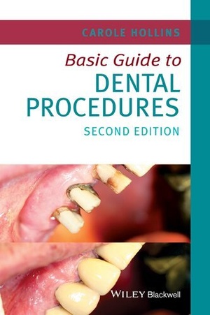 [ FreeCourseWeb ] Basic Guide to Dental Procedures (Basic Guide Dentistry Series), 2nd Edition