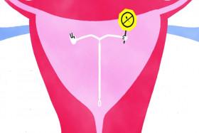 Sex Explained S01E03 WEB X264-STARZ [eztv]