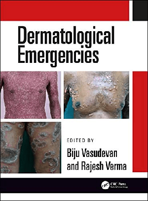 [ FreeCourseWeb ] Dermatological Emergencies