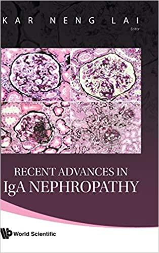 DevCourseWeb Recent Advances in Iga Nephropathy