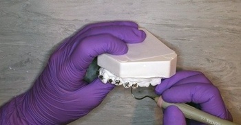 FreeCourseWeb Udemy Fixed appliances treatment and bonding in orthodontics