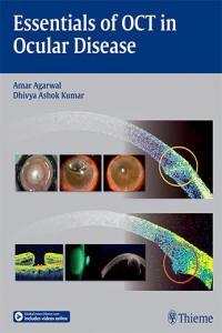 Essentials of OCT in Ocular Disease FreeCourseWeb