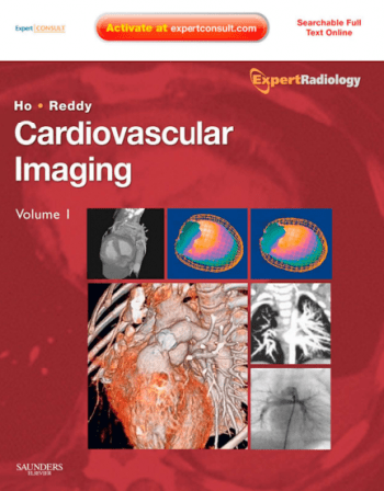 FreeCourseWeb Cardiovascular Imaging 2 Volume Set Expert Radiology Series
