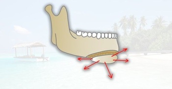 FreeCourseWeb Udemy Surgery Procedures in Orthodontics Cleft Lip and Palate
