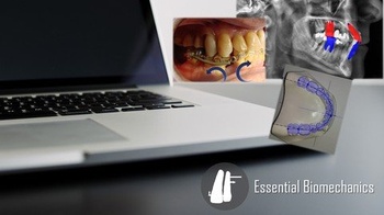 DevCourseWeb Udemy Introduction to Orthodontic Biomechanics