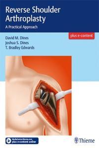 Reverse Shoulder Arthroplasty A Practical Approach ePUB DevCourseWeb