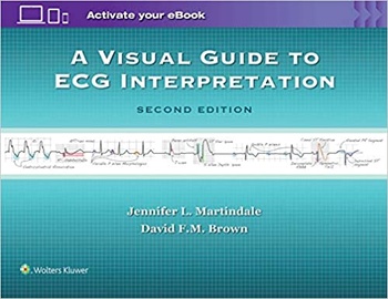 A Visual Guide to ECG Interpretation Second Edition TRUE EPUB