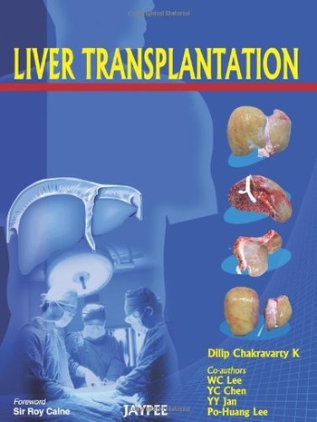 FreeCourseWeb Liver Transplantation
