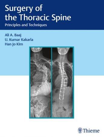 FreeCourseWeb Surgery of the Thoracic Spine Principles and Techniques EPUB