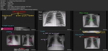 Udemy Let S Master X Rays
