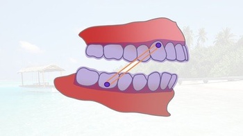 FreeCourseWeb Udemy Clear Aligner Orthodontic Treatment