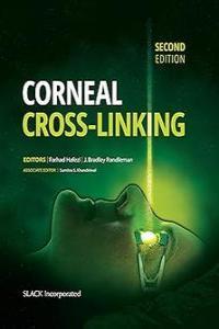 Corneal Cross Linking EPUB CourseWikia